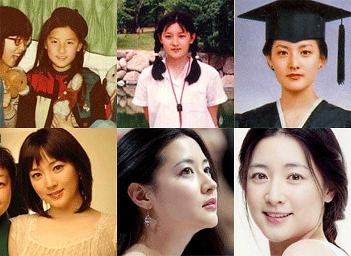 lee young ae no plastic surgery