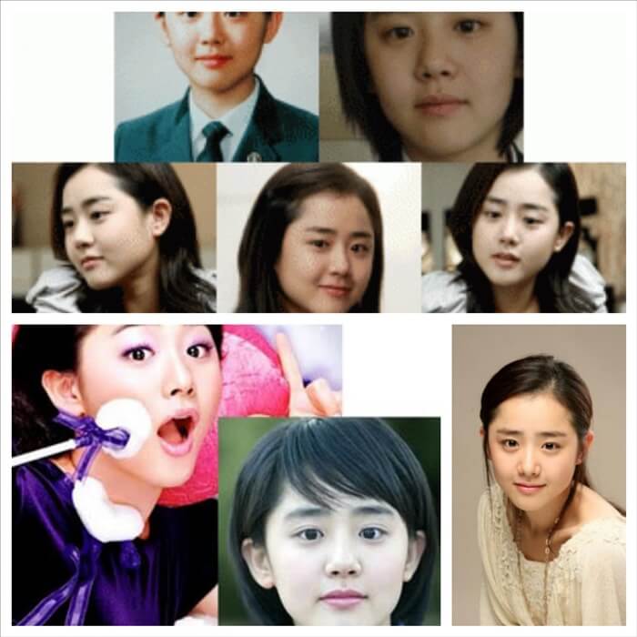 moon geun young no plastic surgery