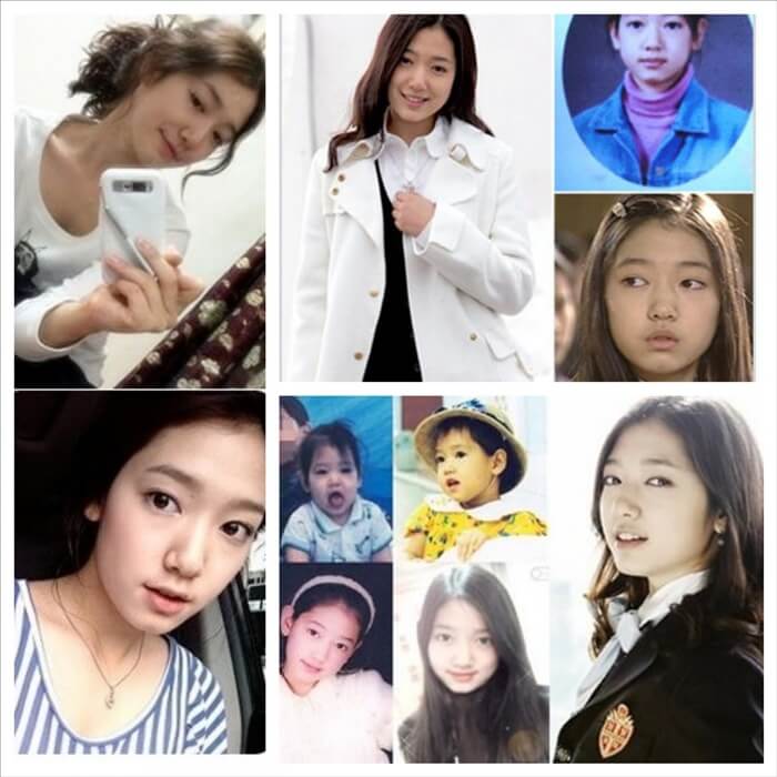 park shin hye no plastic surgery