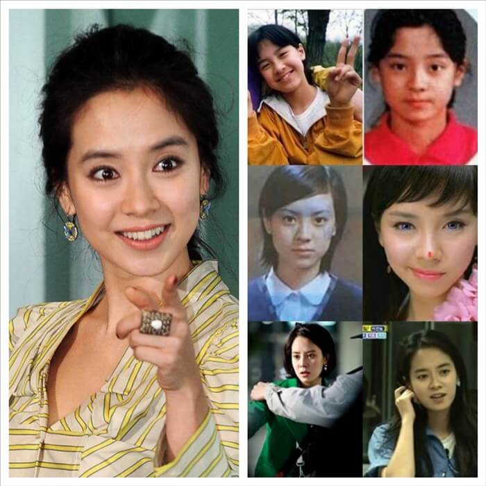 song ji hyo no plastic surgery