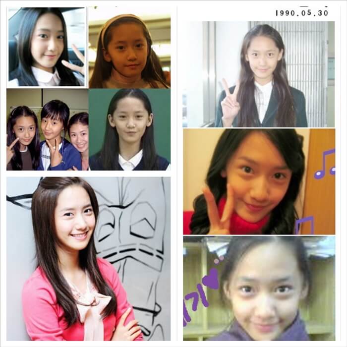 yoona-no-plastic-surgery